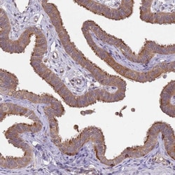 Nephronophthisis Antibody, Novus Biologicals:Antibodies:Primary Antibodies